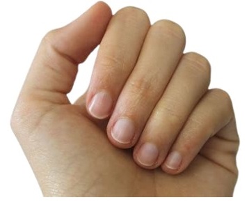 Image of Finger Nails